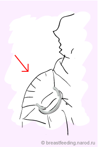 положение слинга на плече